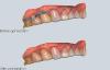 Scanner 3D intra-oral dentaire Aoralscan, scanner 3D professionnelle idéal pour les dentistes et orthodontistes